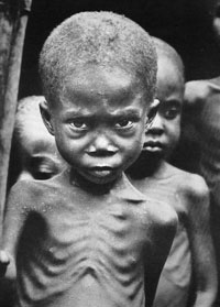 http://shariati.nimeharf.com/wp-content/uploads/2011/03/Starving-in-Biafra.jpg